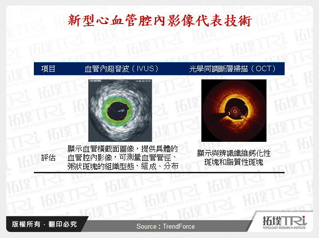 新型心血管腔內影像代表技術