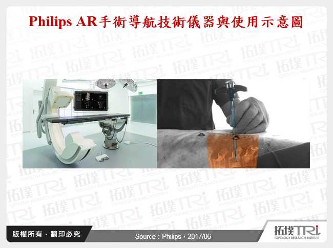 Philips AR手術導航技術儀器與使用示意圖