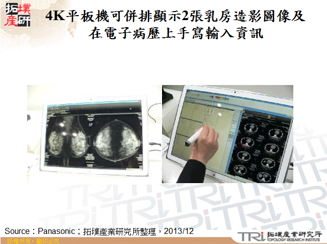 4K平板機可併排顯示2張乳房造影圖像及在電子病歷上手寫輸入資訊