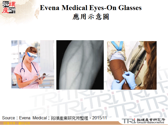 Evena Medical Eyes-On Glasses應用示意圖